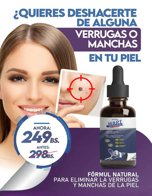 wart remover - ELAYBOL